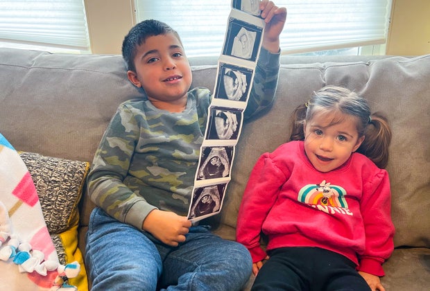 Preparing a child for a new baby: Show ultrasound photos